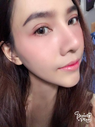 ปากกระจับ - คลินิกศัลยกรรมตกแต่งเสริมสวย รังสิต