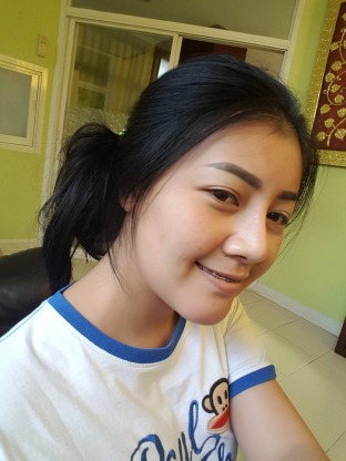 คิ้วสามมิติ - คลินิกศัลยกรรมตกแต่งเสริมสวย รังสิต