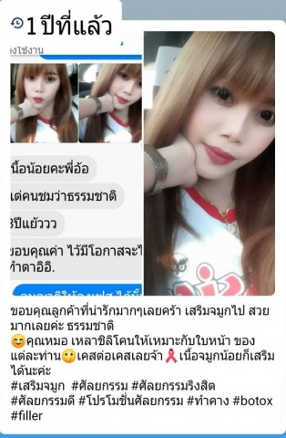 เสริมจมูก