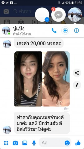 ทำตาสองชั้น หมอจำนงค์