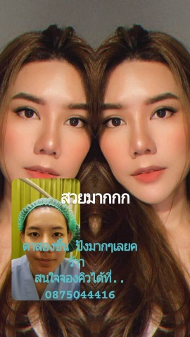 ทำตาสองชั้นหมอจำนงค์