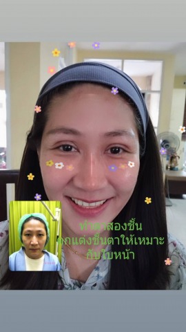 รีวิวทำตา2ชั้น รังสิต